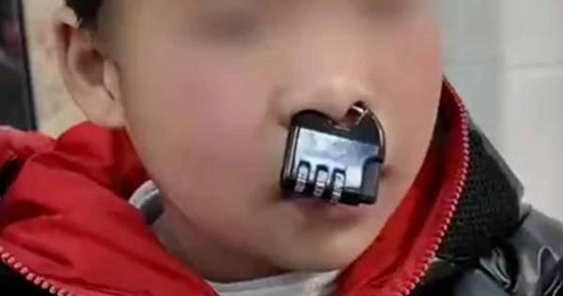 เด็กซนเอาแม่กุญแจคล้องจมูกตัวเอง สุดท้ายเอาออกไม่ได้ (ภาพจาก : CTWANT)