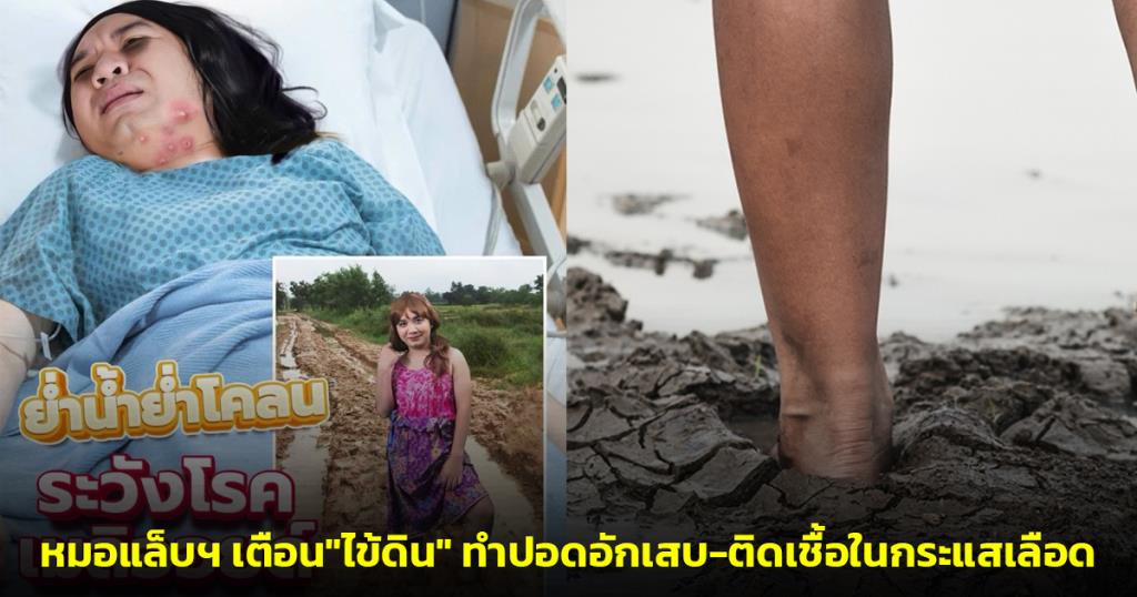 อันตรายถึงชีวิต! หมอแล็บฯ เตือนอย่าเดินเท้าเปล่าย่ำโคลน เชื้อ "ไข้ดิน" ทำปอดอักเสบ-ติดเชื้อในกระแสเลือด