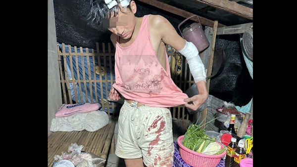 รำวงสงกรานต์ห้างฉัตรฯแรงอีก! LGBTQ หอบร่างสะบักสะบอมร้องสื่อ ช่วยห้ามหลานสาวโดนหลอกรุม ถูกกลุ่มชายฉกรรจ์ชักปืนขู่-สปาต้าฟันสาหัส