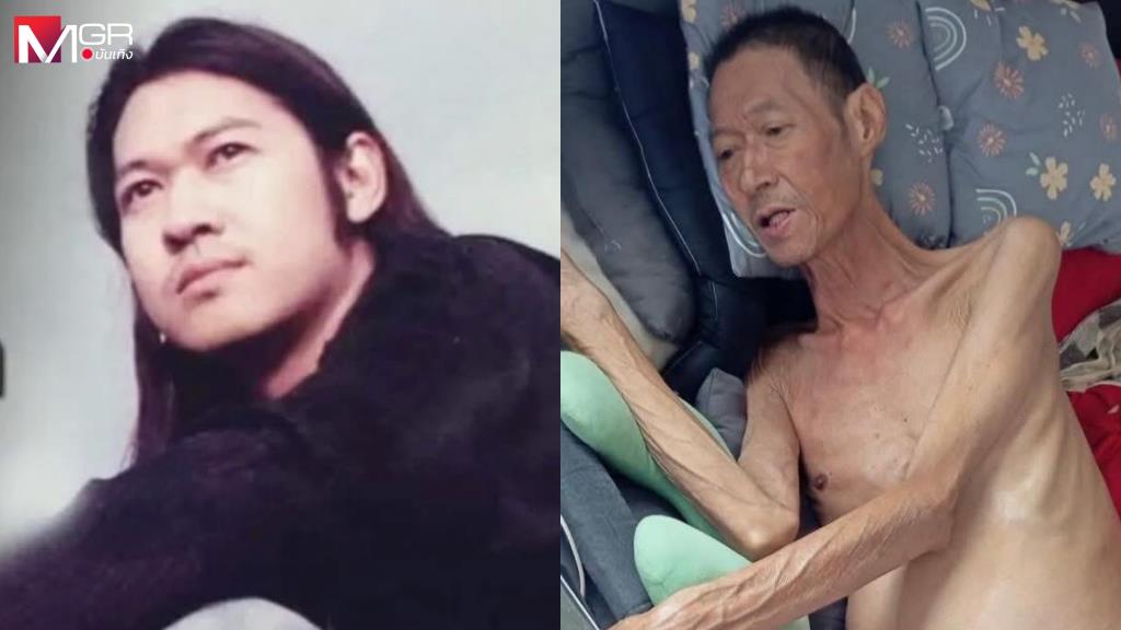 “เท็ดดี้ โลโซ” วอนช่วยค่ารักษา “หม่อง วูล์ฟแพค” ป่วยตับแข็งระยะสุดท้าย เสี่ยงมะเร็ง