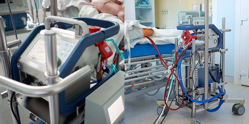 เครื่องเอคโม่ (ภาพจาก : สื่อจีน)