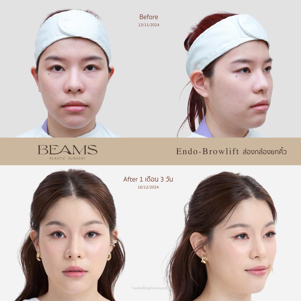 รีวิวยกคิ้วส่องกล้องคุณปาล์ม