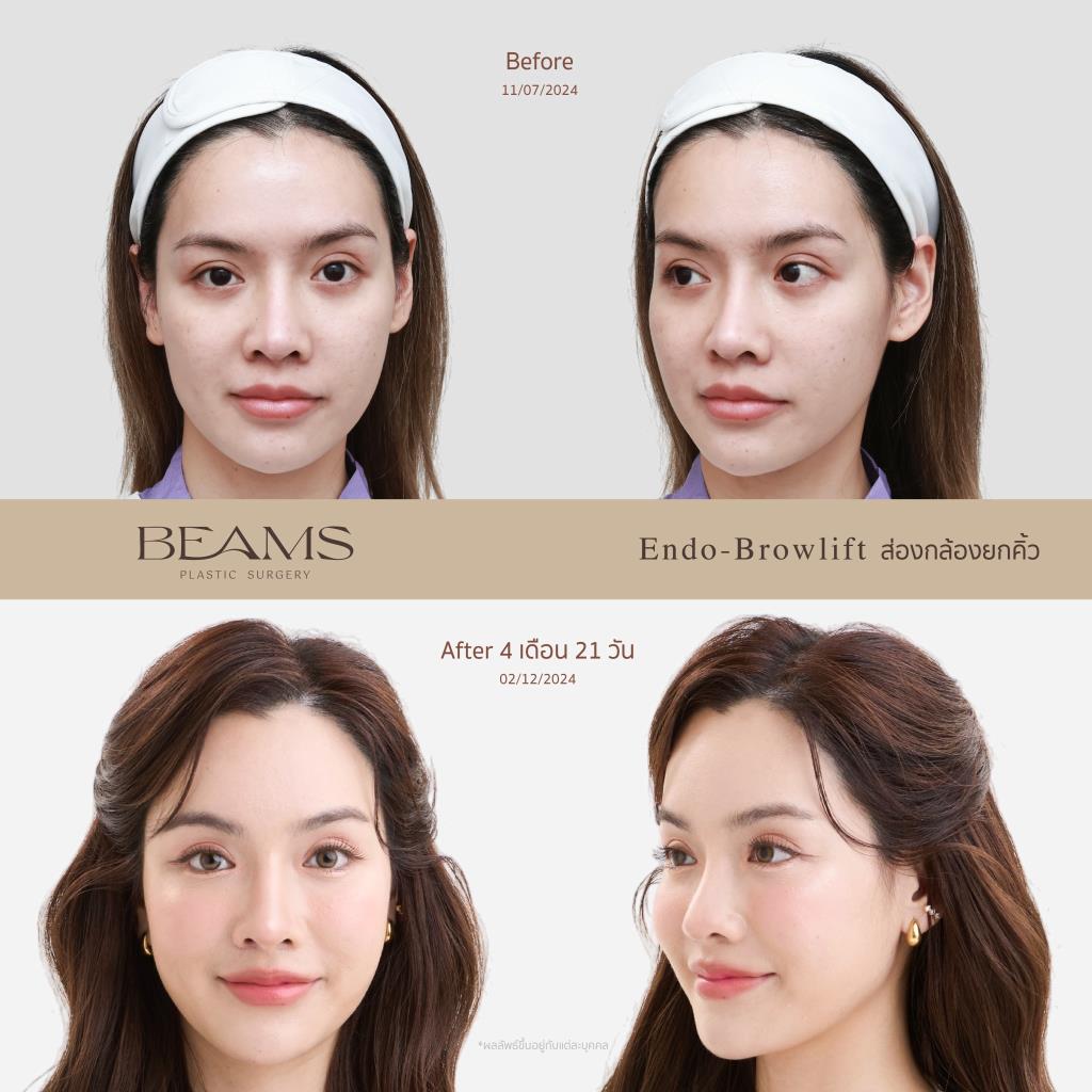 รีวิวยกคิ้วส่องกล้องคุณเอิร์ก