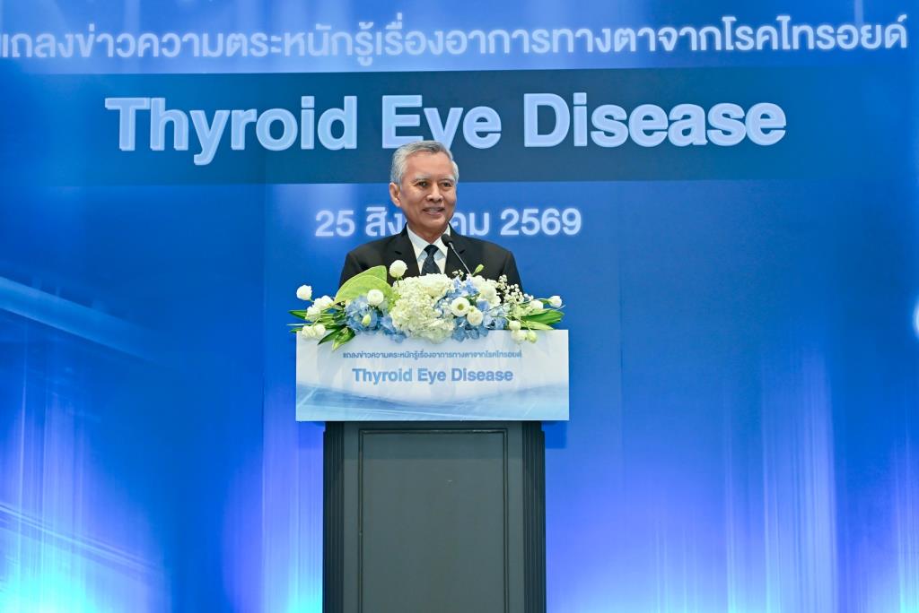 แพทย์เตือน!! ผู้ป่วยไทรอยด์อย่ามองข้ามอาการทางตา เพราะอาจเสี่ยงสูญเสียการมองเห็น-คุณภาพชีวิต