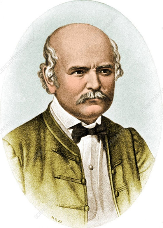 Ignaz Semmelweis ภาพจาก SCIENCE SOURCE / SCIENCE PHOTO LIBRARY