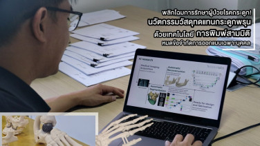 นวัตกรรมวัสดุทดแทนกระดูกพรุนด้วยเทคโนโลยีการพิมพ์สามมิติ พลิกโฉมการรักษาผู้ป่วยโรคกระดูก หมดข้อจำกัดการออกแบบเฉพาะบุคคล