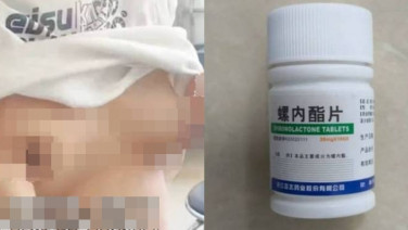 หนุ่ม 17 สุดกลุ้ม! หน้าอกโตเกินชาย หลังซื้อยารักษาสิวมากินเอง