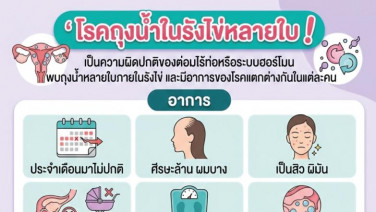 โรคถุงน้ำในรังไข่หลายใบ ภัยเงียบที่ผู้หญิงไม่ควรมองข้าม