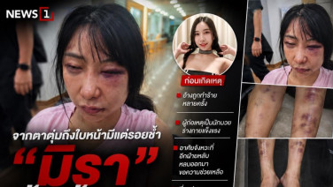 จากตาตุ่มถึงใบหน้ามีแต่รอยช้ำ "มิรา" เข้าแจ้งความทวงความยุติธรรม หลังอ้างถูกทำร้ายต่อเนื่อง