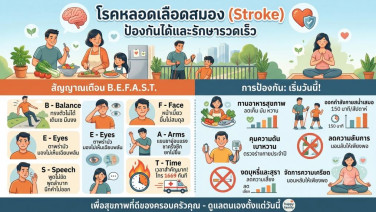 คู่มือชะลอวัยหลอดเลือด: มัดรวมเคล็ดลับป้องกัน ‘สโตรก’ (Stroke) ครบจบในที่เดียว
