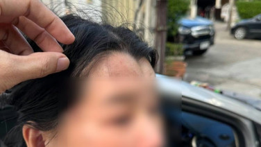 สาววัย 38 ร้องสื่อ! ถูกทนายหนุ่มโหดใช้ขวดน้ำปลาฟาด บีบคอ-รัวหมัดใส่ ต่อหน้าลูก 5 ขวบ จนจมูกหัก กระเทือนสมอง