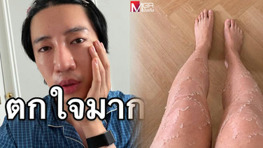 ตกใจมาก! “นนท์ อินทนนท์” เผยภาพลุยน้ำจนขาลอก แต่หักมุมตอนจบ ทำ “เจษ” เมนต์สนั่น