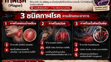 ระวัง! "กาฬโรค" มัจจุราชเงียบ สังเกตอาการด่วนก่อนสาย