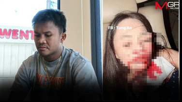 &ldquo;บัวขาว&rdquo;เดือด! น้องสาวโดนแก้วฟันหน้าเจ็บสาหัส คนทำท้าฟ้องศาล ลั่น! ไม่สนใครมีอิทธิพล เตรียมลุยทวงความยุติธรรมถึงที่สุด
