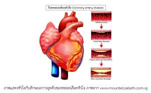 การบริหารจัดการเรื่องสุขภาพและสิ่งแวดล้อมของเมือง อันเป็นระบบที่มีความซับซ้อนสูงมาก (VDO Clip)