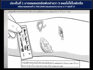 “ปานเทพ” ซัด ผอ.นิติวิทยาศาสตร์ส่งหลักฐานคดี “แตงโม” ล่าช้ากว่า 6 เดือน ยังแถลงแก้ตัวแบบเลื่อนลอยเหมือนเดิม
