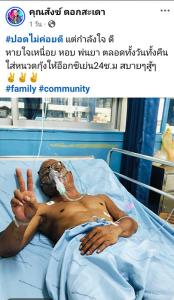 “สังข์ ดอกสะเดา” เตรียมเข้าผ่าตัดก้อนเนื้อที่ปอด หลังถูกหามส่งไอซียูด่วน