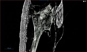 นักวิจัยนานาชาติใช้ซินโครตรอนไทย สำรวจความลับที่ซ่อนในขาตั๊กแตน