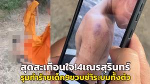 สุดสะเทือนใจ! สามเณรเมืองช้างรุมทำร้ายเด็ก 9 ขวบพร้อมถ่ายคลิป กระทืบเตะต่อยไม้เฆี่ยนตีบุหรี่จี้ระบมทั้งตัว ส่งรักษา รพ.