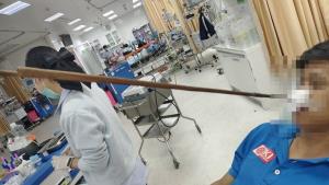 (คลิป)ระทึกนาทีชีวิต! หนุ่มโคราชถูกคู่อริยิงปืนลูกดอกเหล็กปักคาใบหน้าสาหัส กู้ภัยใช้เครื่องพลาสมาตัดออกช่วยชีวิต