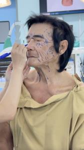 “ฝันเป็นจริง! คุณตา วัย80 เจ้าของไวรัลใช้เทปแปะหน้า พลิกโฉมศัลยกรรมย้อนวัย หล่อเทียบชั้นดารา”