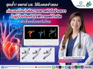 แพทย์ มช.เจ๋ง! ใช้แบบจำลองเสมือนจริงวางแผนผ่าตัดบายพาสหัวใจ สำเร็จครั้งแรกในไทย
