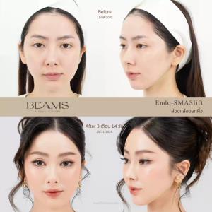 รีวิวยกคิ้วส่องกล้องคุณรัค ชีรีน