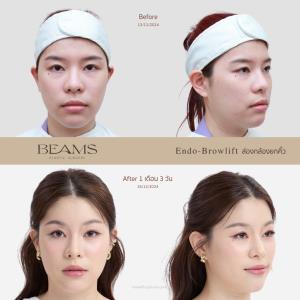 รีวิวยกคิ้วส่องกล้องคุณปาล์ม