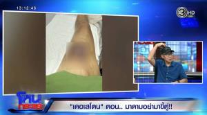 “หนุ่ม นครปฐม” เปิดสมองโดนทำร้าย! เอาผิวที่ขาไปแปะหัว ระบบสมองเปลี่ยน อ้างคนรู้สถานที่นัดหมายคือ “มาดามเก่ง” เล่าความจริงโอนเงินร้อยเดียว