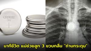 นาทีชีวิต! แม่สติแกร่งช่วยลูก 3 ขวบกลืน "ถ่านกระดุม" เผยเคล็ดลับ "น้ำผึ้ง" ฮีโร่ประวิงเวลาก่อนถึงมือหมอ